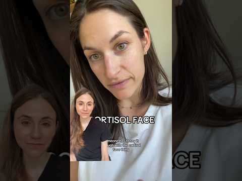 Dr Dray - "You don’t have cortisol face"
